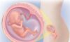 Gebelikte 1. Trimester Belirtileri ve Dikkat Edilecekler